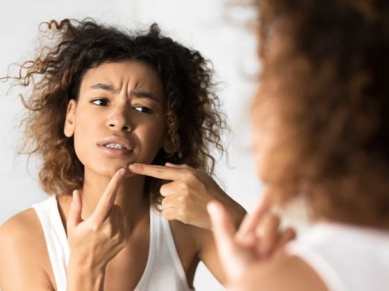 Le confinement : le meilleur moment pour se débarrasser de vos points noirs !